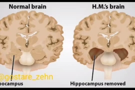 🧠علم حافظه و آزمایش های اچ . ام 🧠